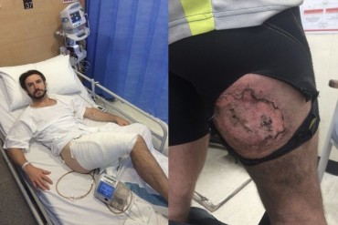 Bikers Rio Pardo | NOTÍCIAS | iPhone6 'explode' e provoca queimadura grave em coxa de ciclista